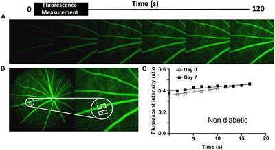 Hydrogen Sulfide Is a Novel Protector of the Retinal Glycocalyx and Endothelial Permeability Barrier